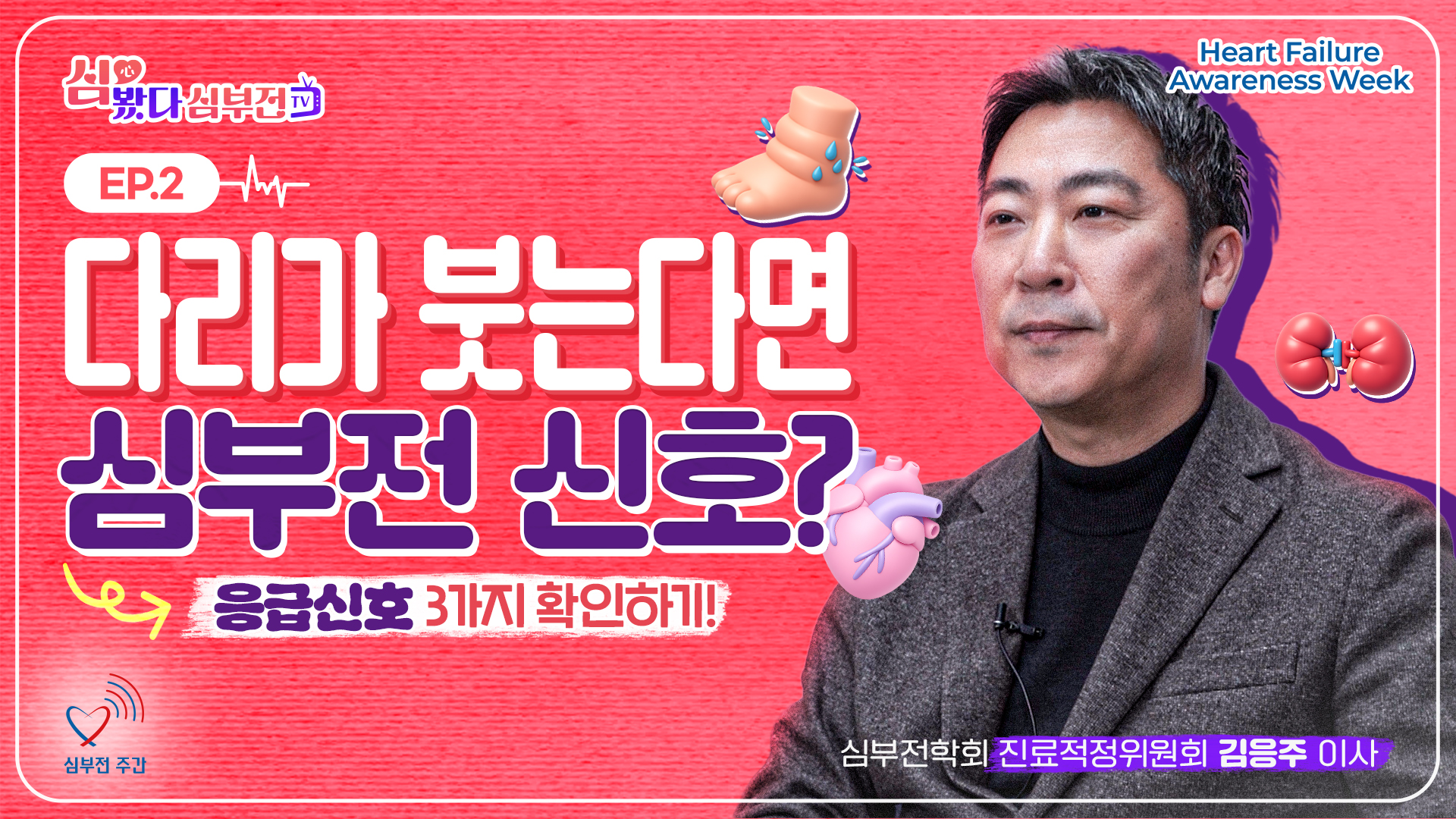 [심봤다, 심부전TV] 다리가 붓는다면 심부전 신호? 응급신호 3가지 확인하기!